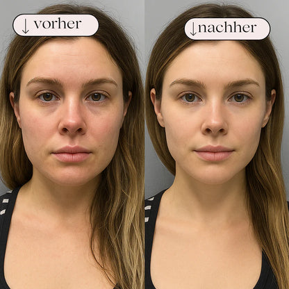 Contour Brush - Straffe Haut in 17 Tagen oder Geld zurück